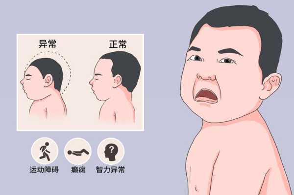 胎儿草莓头(胎儿草莓头是什么畸形) 第3张 胎儿草莓头(胎儿草莓头是什么畸形) 第3张