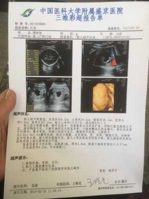 胎儿腹腔囊性包块(子宫囊性包块怎么办) 第1张 胎儿腹腔囊性包块(子宫囊性包块怎么办) 第1张