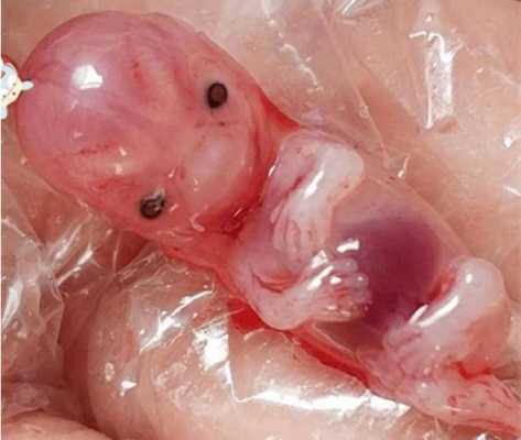 流产的胎儿怎么处理(流产的胎儿怎么处理) 第3张 流产的胎儿怎么处理(流产的胎儿怎么处理) 第3张