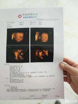 孕期彩超需要空腹吗(彩超不能吃东西吗) 第1张 孕期彩超需要空腹吗(彩超不能吃东西吗) 第1张