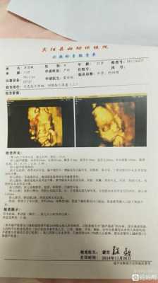 胎儿偏小五天(胎儿偏小五天正常吗) 第2张 胎儿偏小五天(胎儿偏小五天正常吗) 第2张
