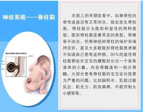 胎儿隐性脊柱裂(隐形脊柱裂怎么治疗) 第2张 胎儿隐性脊柱裂(隐形脊柱裂怎么治疗) 第2张