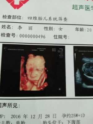 四维检查结果正常,但是宝宝脸上有东西是什么,四维图片胎儿全图 第2张 四维检查结果正常,但是宝宝脸上有东西是什么,四维图片胎儿全图 第2张