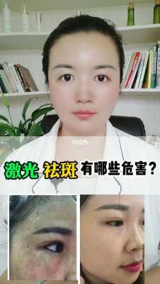 孕妇可以激光祛斑吗,激光对胎儿有影响吗? 第2张 孕妇可以激光祛斑吗,激光对胎儿有影响吗? 第2张