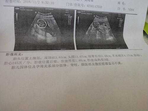 胎儿十六周有多大(怀孕16周胎心多少正常) 第2张 胎儿十六周有多大(怀孕16周胎心多少正常) 第2张