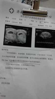 胎儿性暗区(胎儿腹部暗区) 第1张 胎儿性暗区(胎儿腹部暗区) 第1张