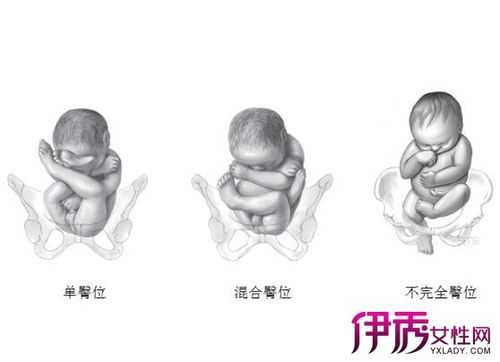 32周胎儿的头在哪里?怀孕32周,臀位怎么办,孕32周胎儿图片真实 第1张 32周胎儿的头在哪里?怀孕32周,臀位怎么办,孕32周胎儿图片真实 第1张