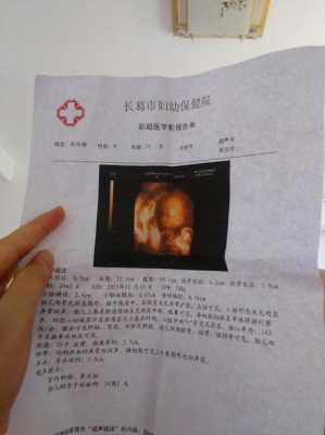 24周胎儿四维彩超(24周胎儿四维彩超数据) 第1张 24周胎儿四维彩超(24周胎儿四维彩超数据) 第1张