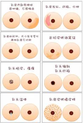 孕妇胸部里面有硬块需要揉散了吗,孕期乳房有硬块怎么办呢 第1张 孕妇胸部里面有硬块需要揉散了吗,孕期乳房有硬块怎么办呢 第1张