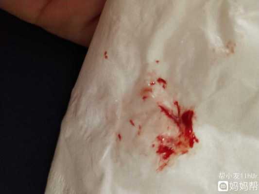 孕期流鼻血了(怀孕流鼻血是怎么回事) 第1张 孕期流鼻血了(怀孕流鼻血是怎么回事) 第1张