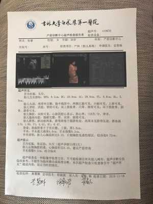 胎儿心胸比增大(胎儿心胸比增大) 第1张 胎儿心胸比增大(胎儿心胸比增大) 第1张