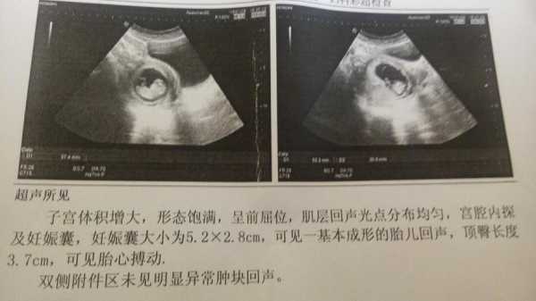 正常胎儿后（70天的宝宝平时正常的表现有哪些）  第1张