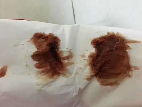 孕期咖啡色(怀孕初期有褐色的东西是什么原因) 第2张 孕期咖啡色(怀孕初期有褐色的东西是什么原因) 第2张