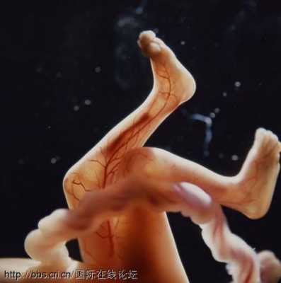 怀孕11周胎儿稳定了吗?多少周才能稳定,孕11周胎儿图片 b超 第3张 怀孕11周胎儿稳定了吗?多少周才能稳定,孕11周胎儿图片 b超 第3张
