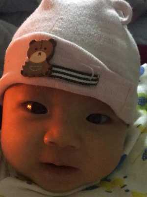刚出生的婴幼儿的皮肤是都很白吗?为啥我的宝宝皮肤很黑,胎儿黑是什么原因 第2张 刚出生的婴幼儿的皮肤是都很白吗?为啥我的宝宝皮肤很黑,胎儿黑是什么原因 第2张