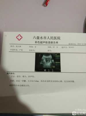 孕期5周(刚知道怀孕5周,可以吃药打胎嘛) 第3张 孕期5周(刚知道怀孕5周,可以吃药打胎嘛) 第3张