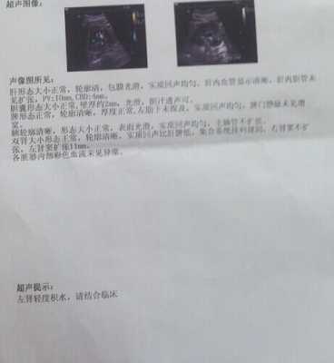 朋友怀孕去产检,查出胎儿肾积水,正常值是多少啊,胎儿有积水是什么意思 第2张 朋友怀孕去产检,查出胎儿肾积水,正常值是多少啊,胎儿有积水是什么意思 第2张