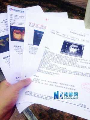 b超单计算胎儿体重(请问35周胎儿有多重?怎么算的呢) 第2张 b超单计算胎儿体重(请问35周胎儿有多重?怎么算的呢) 第2张