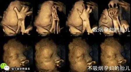 吸烟对胎儿（吸烟对胎儿的影响到底有多大）  第1张