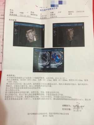 13岁女孩143厘米还可以长多高,胎儿心率143是男孩儿是女孩儿 第3张 13岁女孩143厘米还可以长多高,胎儿心率143是男孩儿是女孩儿 第3张
