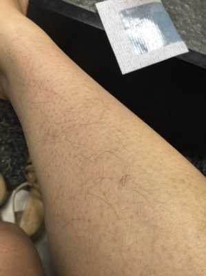 孕期脱毛(孕期脱毛有什么影响) 第2张 孕期脱毛(孕期脱毛有什么影响) 第2张