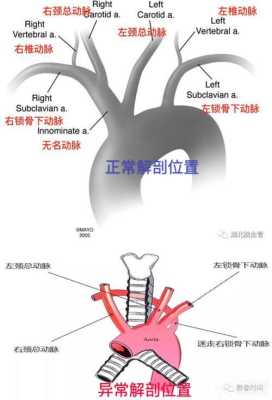 胎儿迷(胎儿迷走右锁骨下动脉什么意思) 第1张 胎儿迷(胎儿迷走右锁骨下动脉什么意思) 第1张