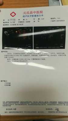 孕期或者产后发生子宫肌瘤怎么办,孕期有子宫肌瘤怎么办,但后期b超没有 第2张 孕期或者产后发生子宫肌瘤怎么办,孕期有子宫肌瘤怎么办,但后期b超没有 第2张
