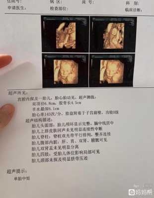 四维胎儿趴着怎么办（做四维彩超孩子趴着，看不到脸，怎么办）  第1张