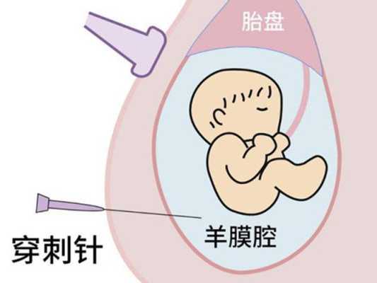 胎儿肠管回声稍增强(胎儿腹部肠管回声增强必须做羊穿吗) 第1张 胎儿肠管回声稍增强(胎儿腹部肠管回声增强必须做羊穿吗) 第1张