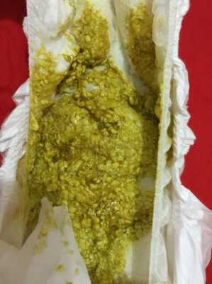 6个月宝宝大便有奶瓣是怎么回事？有奶瓣该怎么缓解,孕6个月胎儿体重标准是多少  第2张