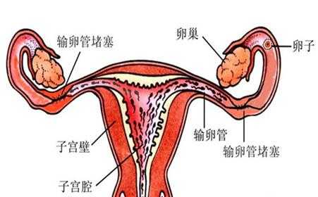 胎儿是生活在（  ） ，A．输卵管，B．子宫，C．卵巢，D．阴,胎儿卵巢囊肿是什么原因引起的 第2张