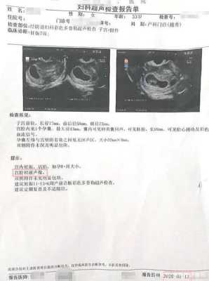 怀孕了但是有积液,怎么办,胎儿有积液对胎儿有什么影响呢? 第1张 怀孕了但是有积液,怎么办,胎儿有积液对胎儿有什么影响呢? 第1张