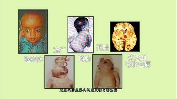 出生15天的宝宝金葡菌血液感染,这病严重吗,胎儿感染弓形虫的症状 第1张 出生15天的宝宝金葡菌血液感染,这病严重吗,胎儿感染弓形虫的症状 第1张