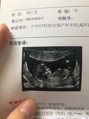 孕34周开始总感觉宝宝一直在左侧动正常吗,胎儿左边动的多是男孩还是女孩 第2张 孕34周开始总感觉宝宝一直在左侧动正常吗,胎儿左边动的多是男孩还是女孩 第2张
