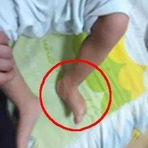 胎儿脑瘫吗(孕妇高潮宫缩会导致胎儿脑瘫吗) 第1张 胎儿脑瘫吗(孕妇高潮宫缩会导致胎儿脑瘫吗) 第1张