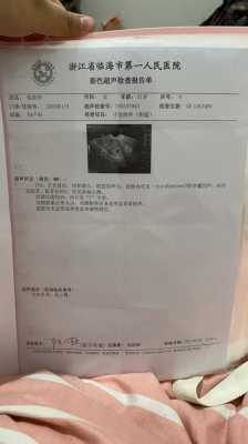 产假45天怎么办,孕期45天可以有胎心吗 第2张 产假45天怎么办,孕期45天可以有胎心吗 第2张