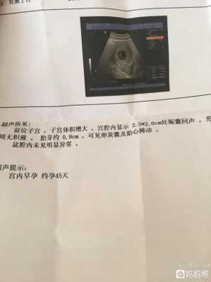 产假45天怎么办,孕期45天可以有胎心吗 第3张 产假45天怎么办,孕期45天可以有胎心吗 第3张