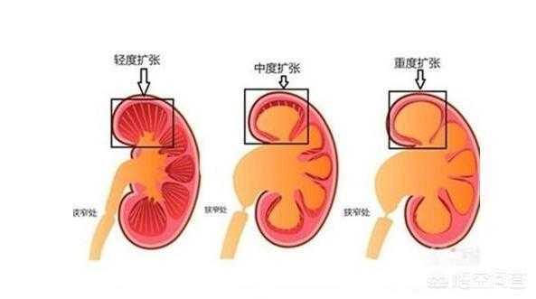 胎儿肾脏(胎儿肾脏发育时间) 第2张 胎儿肾脏(胎儿肾脏发育时间) 第2张