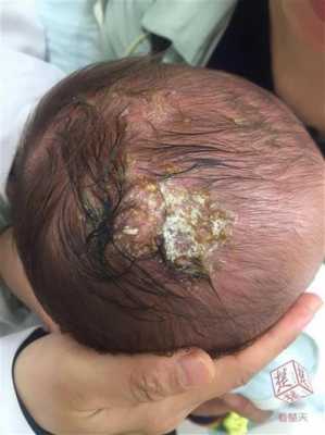 刚出生的小宝宝头部比较长,能不能恢复,胎儿头长得快怎么回事 第3张 刚出生的小宝宝头部比较长,能不能恢复,胎儿头长得快怎么回事 第3张