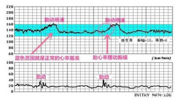 胎儿心跳看男女(胎儿心跳看男女准确吗) 第2张 胎儿心跳看男女(胎儿心跳看男女准确吗) 第2张