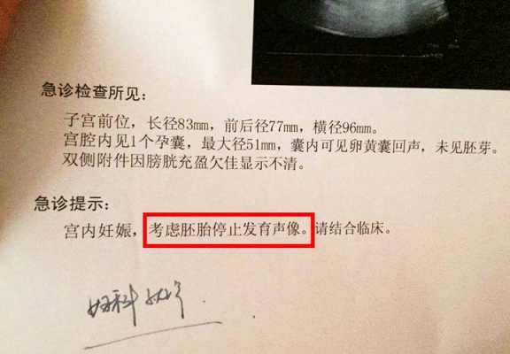 胎儿无胎心原因(胎儿突然没有胎心原因是什么啊?是胎停了吗) 第2张 胎儿无胎心原因(胎儿突然没有胎心原因是什么啊?是胎停了吗) 第2张