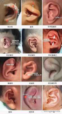 孕期胎儿畸形(宝宝耳朵怎么会畸形的啊?怀孕期间需要注意哪些呢) 第2张 孕期胎儿畸形(宝宝耳朵怎么会畸形的啊?怀孕期间需要注意哪些呢) 第2张