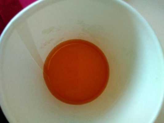 孕期尿红(孕期尿红) 第2张 孕期尿红(孕期尿红) 第2张