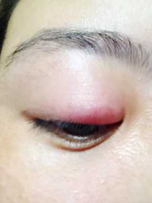 孕期眼疼(孕期眼疼是什么原因) 第2张 孕期眼疼(孕期眼疼是什么原因) 第2张