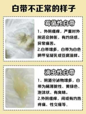 孕期白带发黄正常吗(怀孕初期白带发黄怎么办) 第2张 孕期白带发黄正常吗(怀孕初期白带发黄怎么办) 第2张