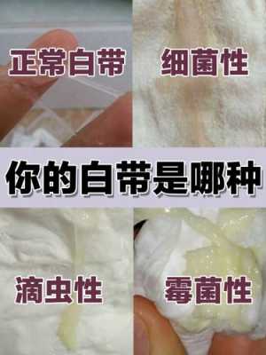 孕期白带发黄正常吗(怀孕初期白带发黄怎么办) 第1张 孕期白带发黄正常吗(怀孕初期白带发黄怎么办) 第1张