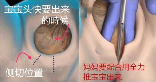 孕40周胎儿孕检估计8斤能顺产吗,胎儿多大可以顺产不侧切 第2张 孕40周胎儿孕检估计8斤能顺产吗,胎儿多大可以顺产不侧切 第2张