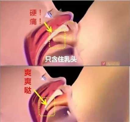 孕期乳头小(乳头短,宝宝吃奶含不住怎么办) 第1张 孕期乳头小(乳头短,宝宝吃奶含不住怎么办) 第1张