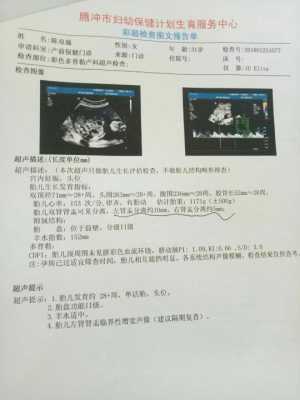 胎儿检查双肾窦稍分离,要紧吗,胎儿双侧肾窦分离应该注意什么 第2张 胎儿检查双肾窦稍分离,要紧吗,胎儿双侧肾窦分离应该注意什么 第2张