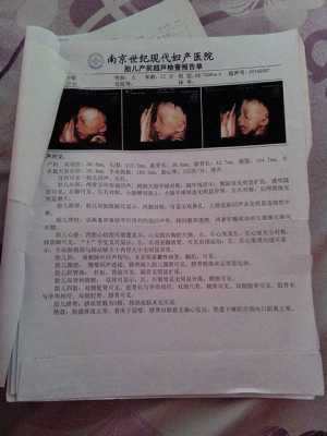 胎儿40mm（23周股骨长40mm正常吗？才做的彩超检查，上次检查胎儿还偏小了）  第2张